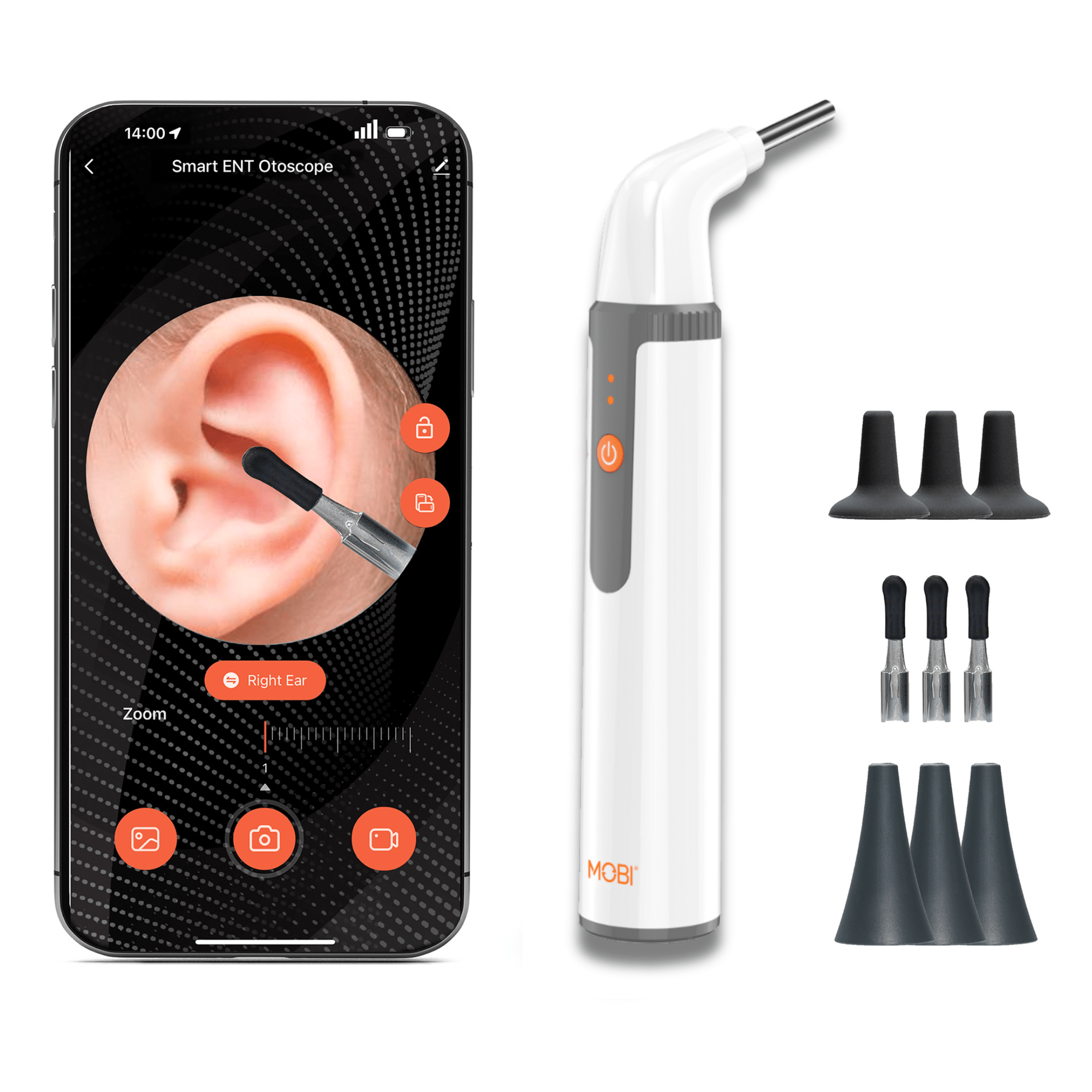 MOBI Ear, Nose & Throat Smart Otoscope Jr. HD Camera - 1080P HD Lens, Multi - Axis Gyroscope, 6 LED Lights, 90+ Min Use, - MOBI USA