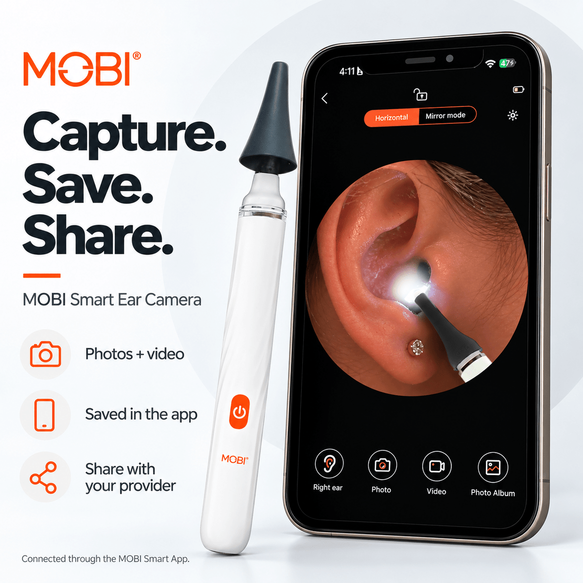 MOBI Smart Ear, Nose & Throat Camera - MOBI USA