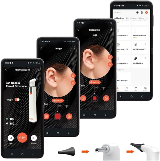 10 - Piece Speculum Set for Use with MOBI Smart Bluetooth Otoscope - Professional Grade Accessories for Ear, Nose, and Throat Examination - MOBI USA