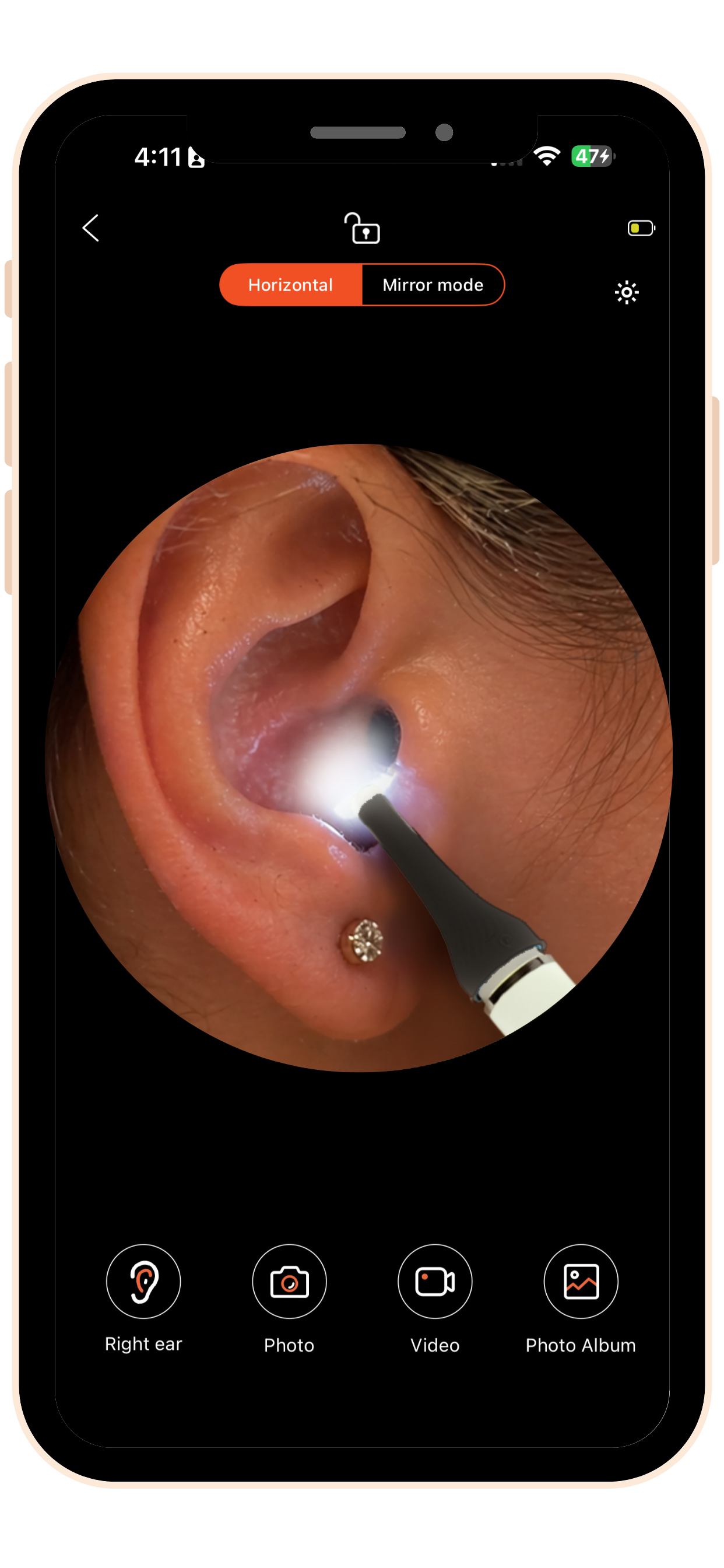 MOBI Smart Ear, Nose & Throat Camera