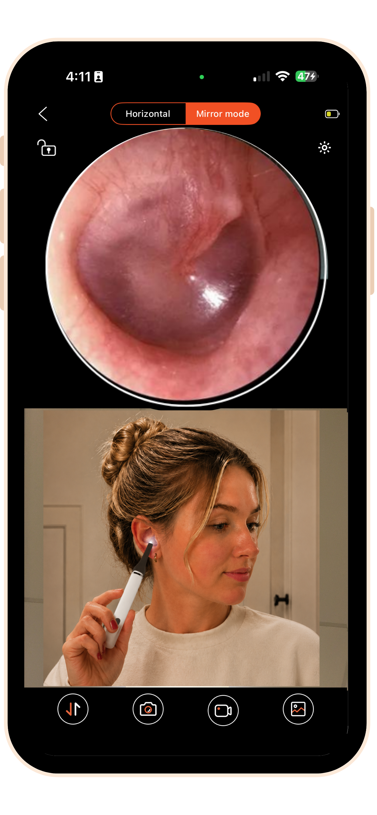 MOBI Smart Ear, Nose & Throat Camera