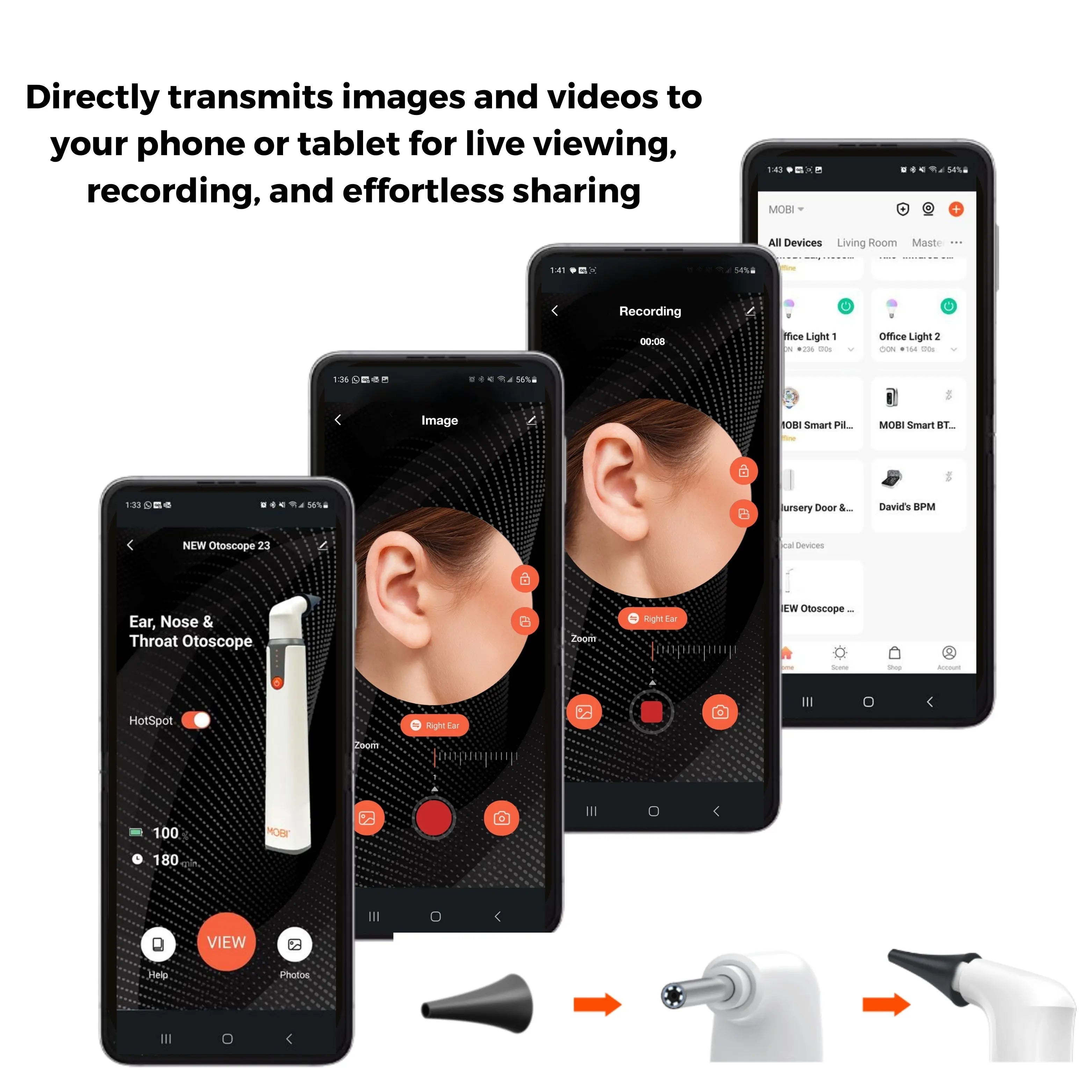 Ear, Nose & Throat Smart Wi-Fi Otoscope With HD Camera MOBI Technologies Inc.