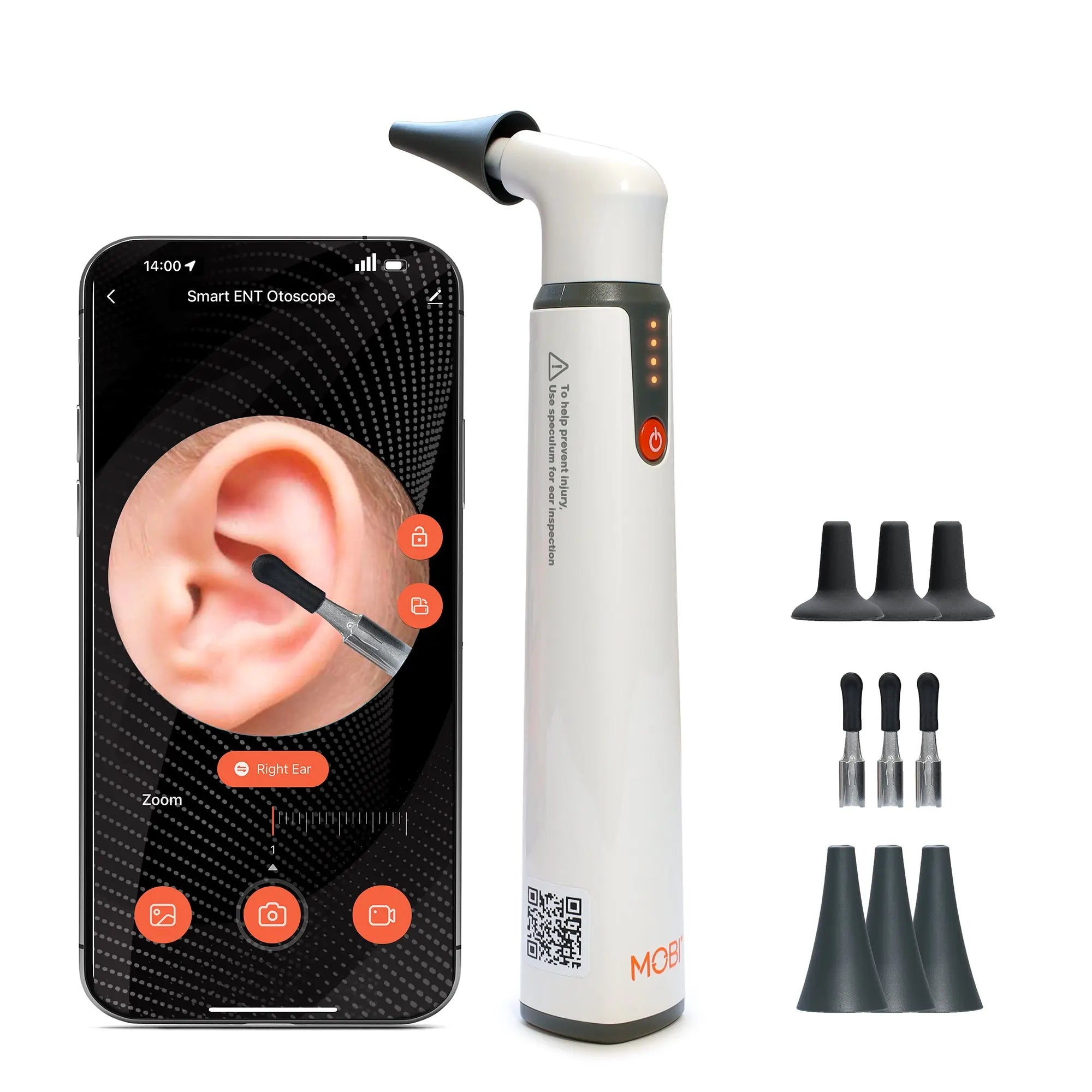 MOBI Ear, Nose & Throat Smart Otoscope Jr. HD Camera - 1080P HD Lens, Multi - Axis Gyroscope, 6 LED Lights, 90+ Min Use, - MOBI USA