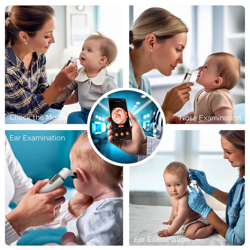 MOBI Ear, Nose & Throat Smart Otoscope Jr. HD Camera-1080P HD Lens,