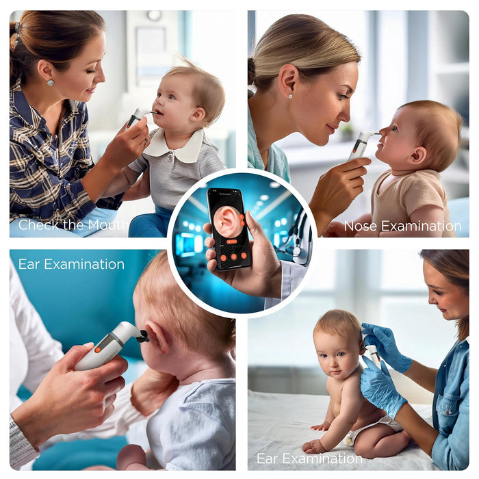 MOBI Smart Otoscope Jr. | 1080P HD Ear Nose Throat Camera, Gyroscope ...