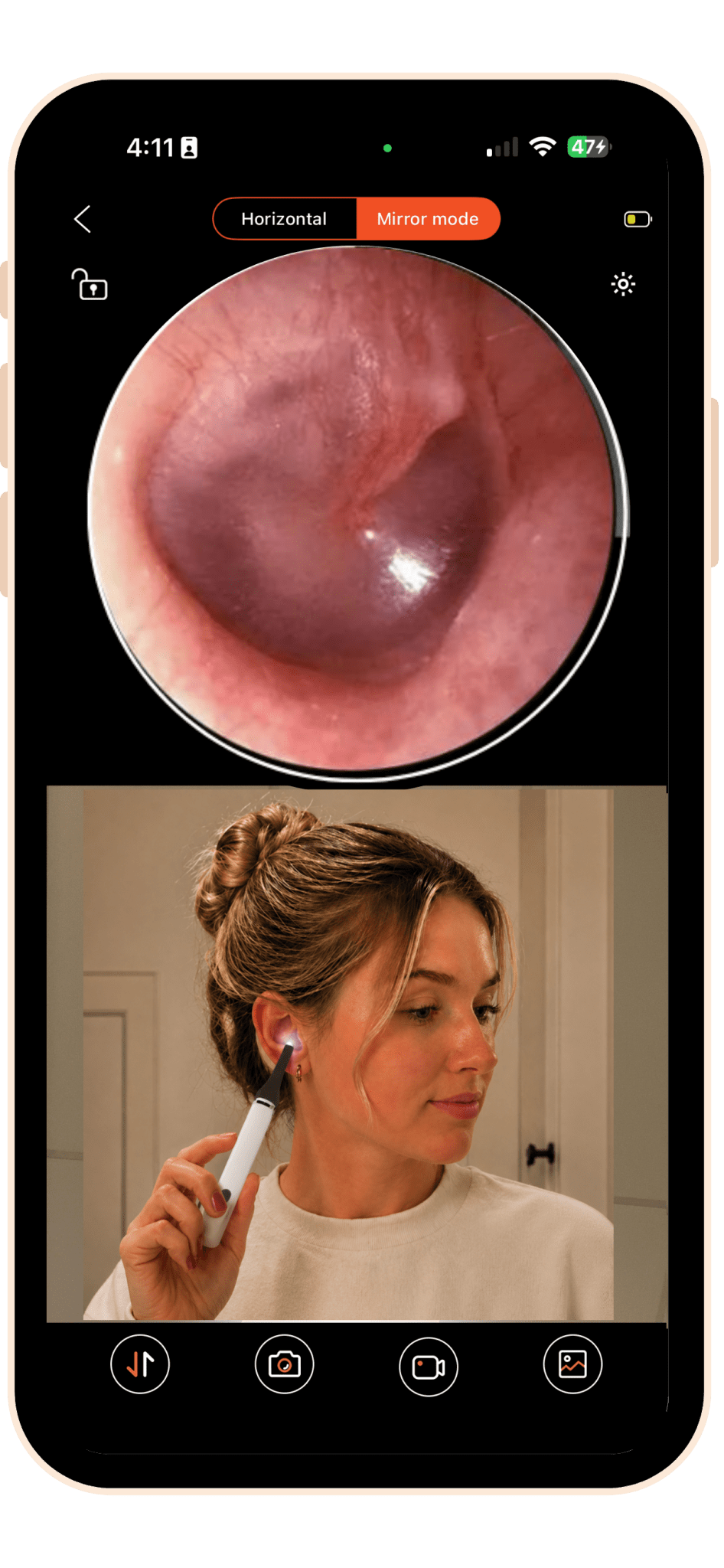 MOBI Smart Ear, Nose & Throat Camera - MOBI USA