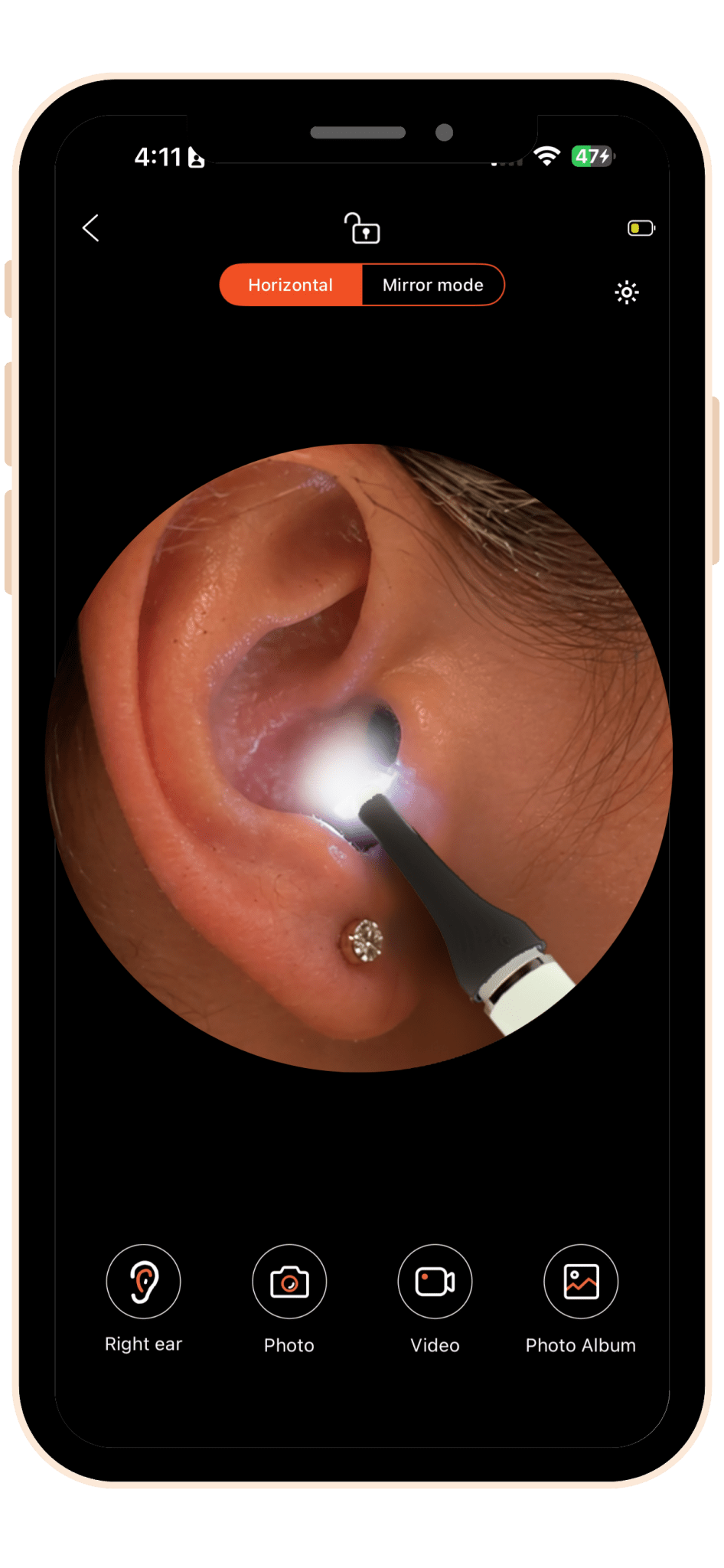 MOBI Smart Ear, Nose & Throat Camera - MOBI USA