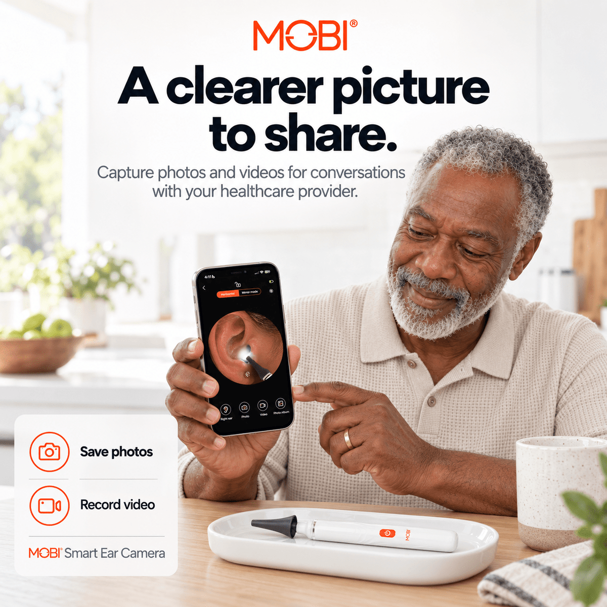 MOBI Smart Ear, Nose & Throat Camera - MOBI USA