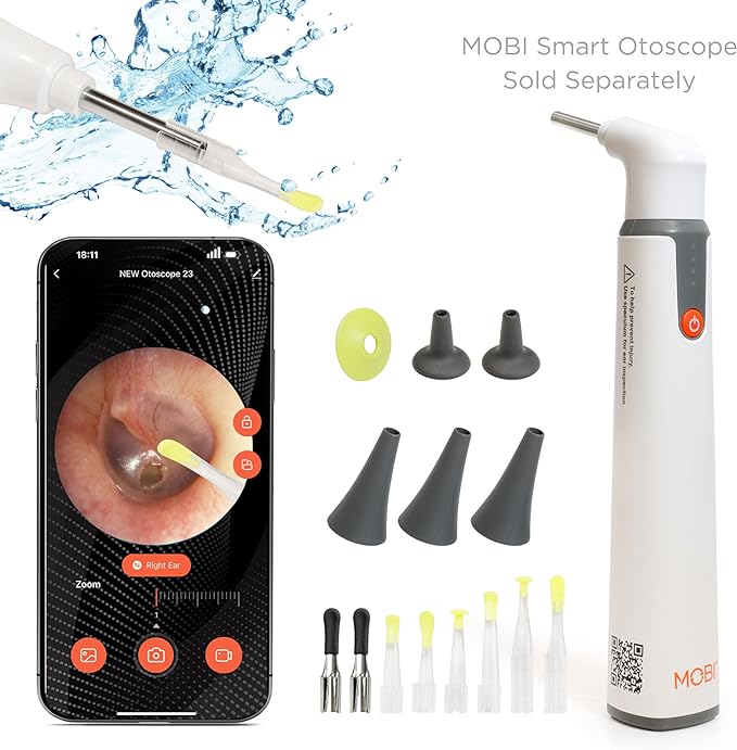 MOBI Smart Otoscope Ear Cleaning Accessory Kit - Compatible with MOBI Smart Otoscope, Ear Wax Removal Tool Convenient at - Home Ear Examinations - Ultimate Solution for Earwax Build - Up and Itchy Ears - MOBI USA