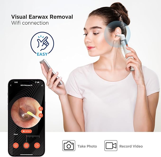 MOBI Smart Otoscope Ear Cleaning Accessory Kit - Compatible with MOBI Smart Otoscope, Ear Wax Removal Tool Convenient at - Home Ear Examinations - Ultimate Solution for Earwax Build - Up and Itchy Ears - MOBI USA